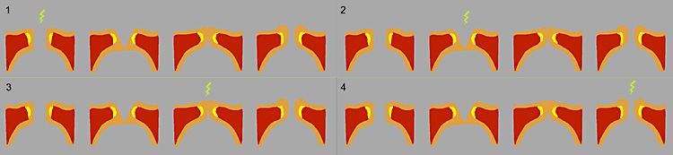 Stroboskopische Beleuchtung der Stimmlippen jeweils eine Phase versetzt im folgenden Schwingungszyklus